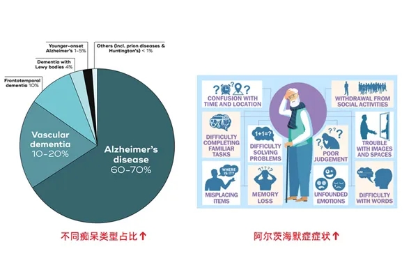 图1. 阿尔茨海默症症状及其在痴呆中的比例[1, 2]