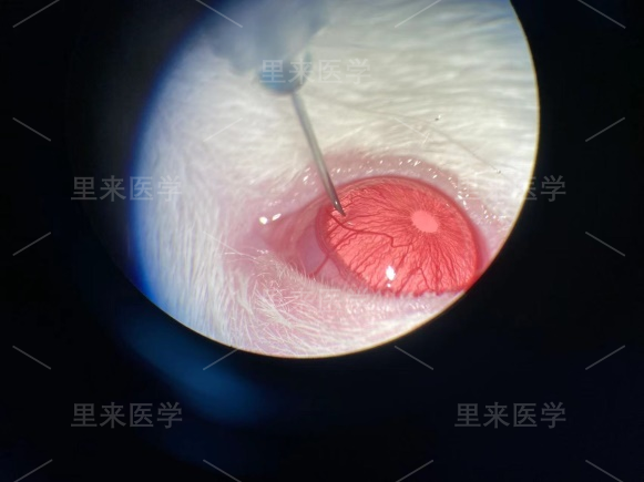 手术造模照片1。.png