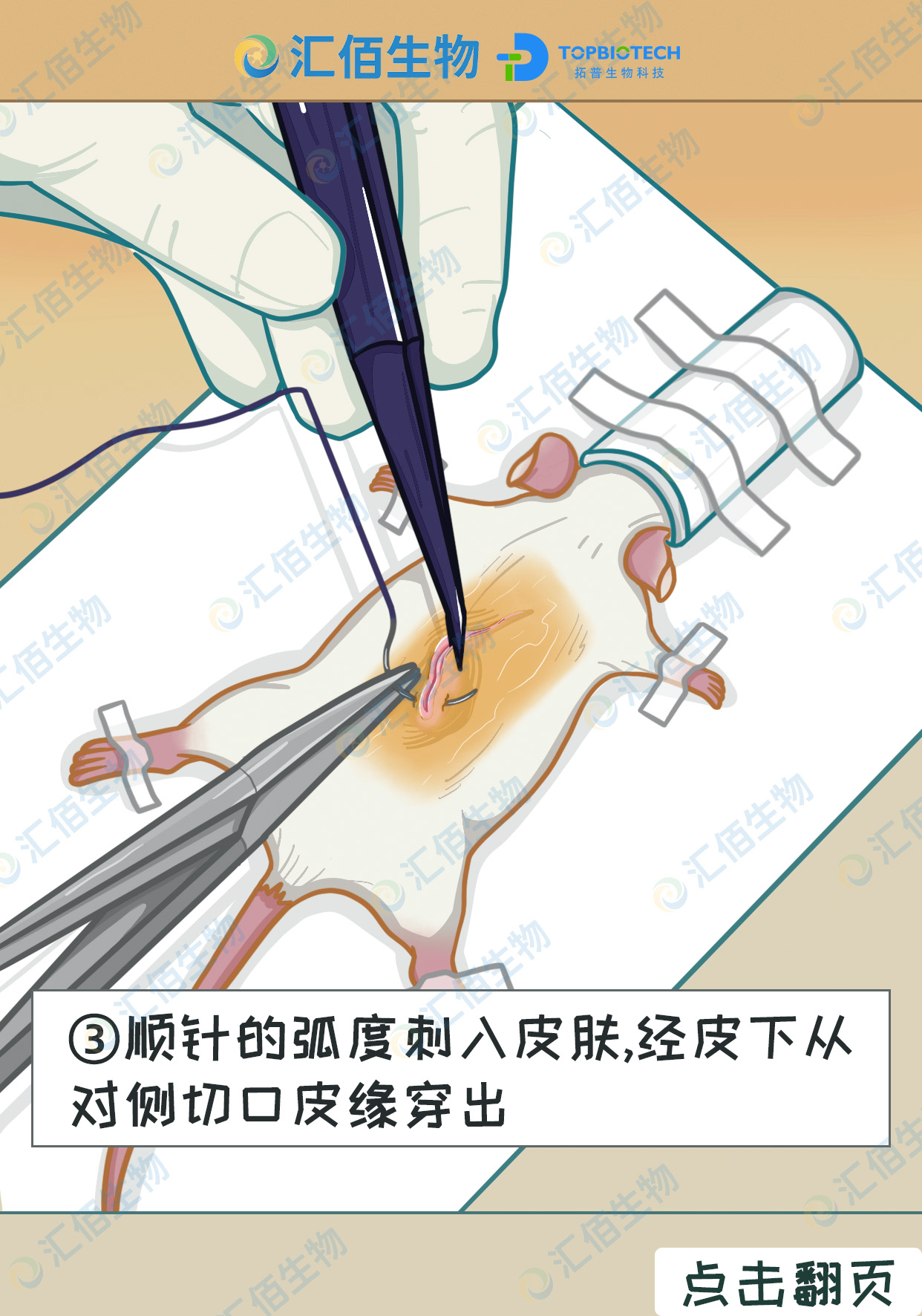 03步骤三,顺针的弧度刺入皮肤,经皮下从对侧切口皮缘穿出.jpg