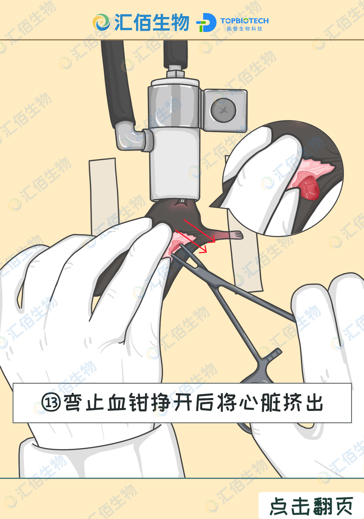 13步骤十三;钝弯止血钳挣开后将心脏挤出.jpg