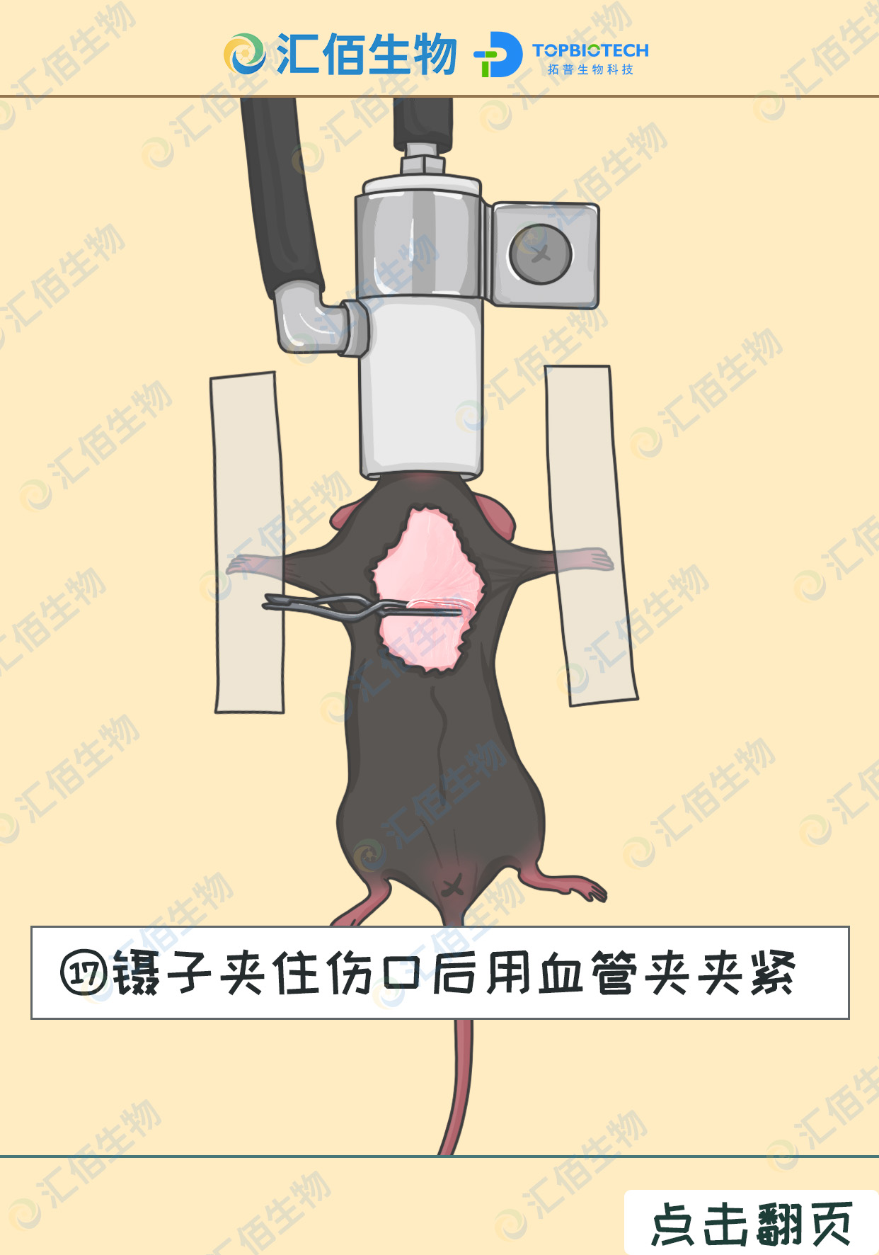 17步骤十七;镊子夹住伤口后用血管夹夹紧.jpg