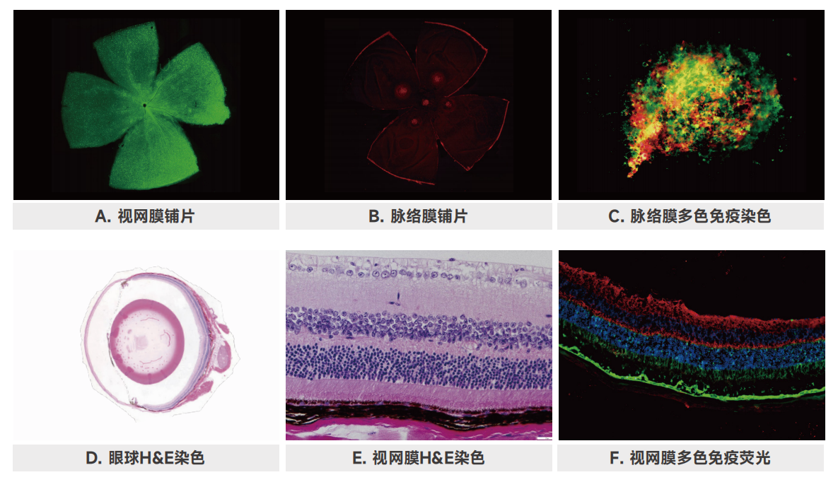 眼科疾病模型及其应用研究