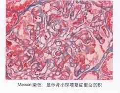 Masson 染色实验动物大小鼠猪犬猴猫鸡鸭鹅羊兔人等