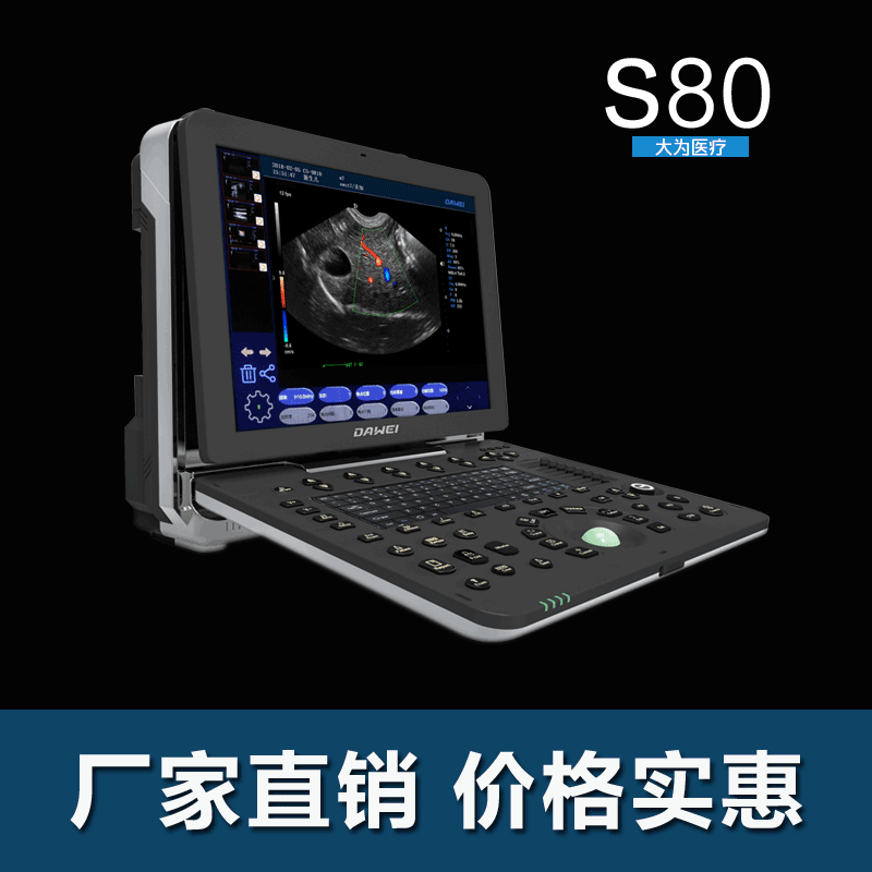 大小鼠用/科研用高清彩色b超机