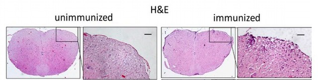 实验性自身免疫性脑脊髓炎模型（EAE）