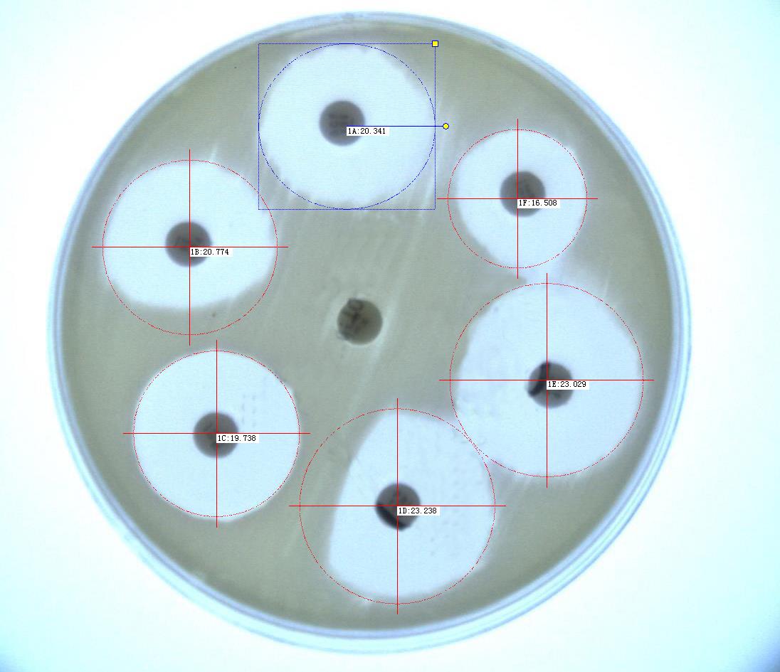 HICC-T全自动抑菌圈测量仪抗生素效价分析仪药敏分析仪