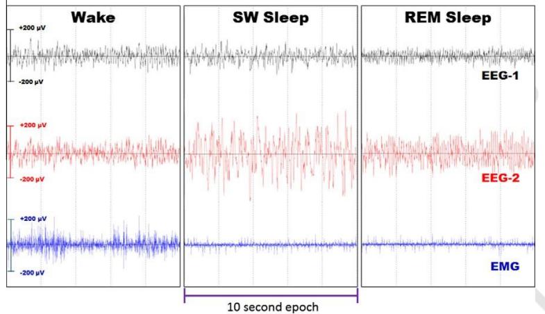 小动物睡眠监测系统（EEG/EMG）