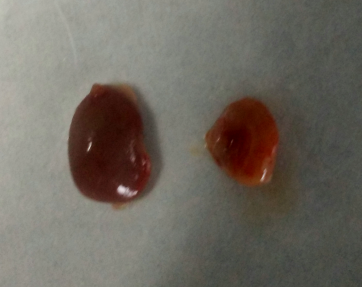 整体试验服务--动物疾病模型构建--小鼠肾纤维化模型