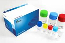 甲型流感病毒(IAV)核酸检测试剂盒(PCR-荧光探针法)