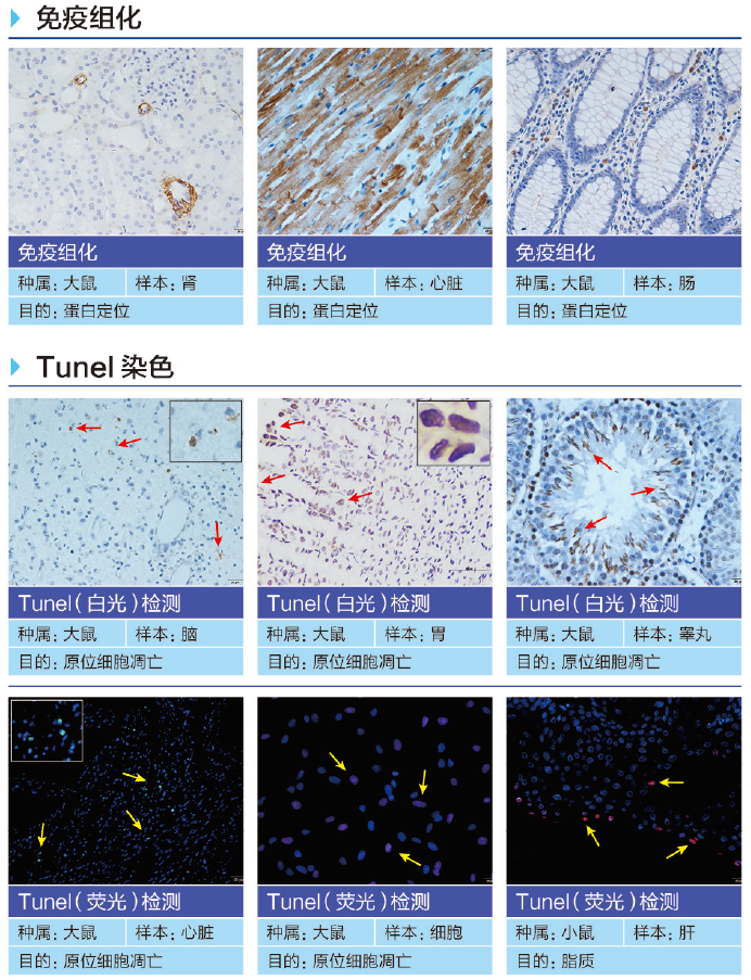 免疫组化与Tunel染色