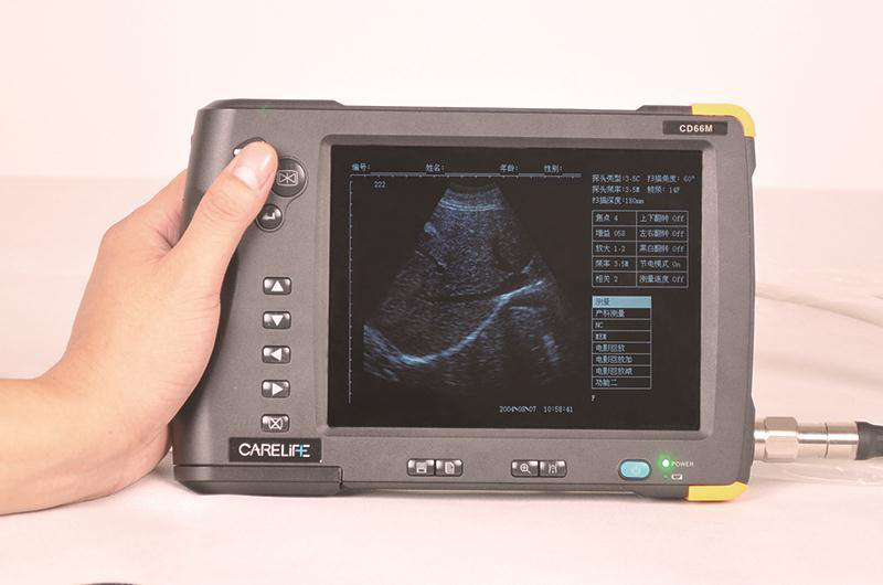 CD66M掌上B型超声诊断仪
