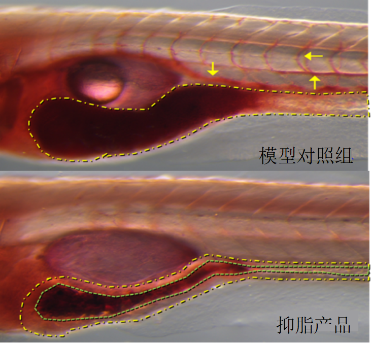 利用斑马鱼模型评价抑脂功效