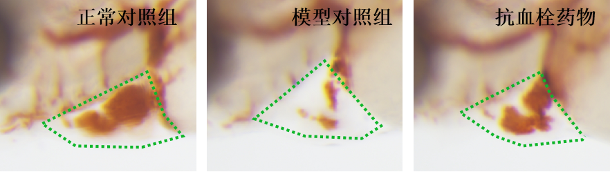 利用斑马鱼模型评价抗血小板聚集性血栓作用