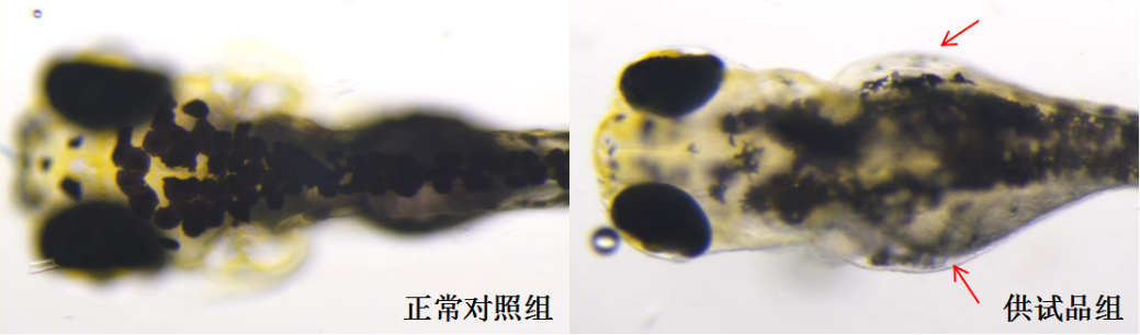 利用斑马鱼模型评价肾脏毒性