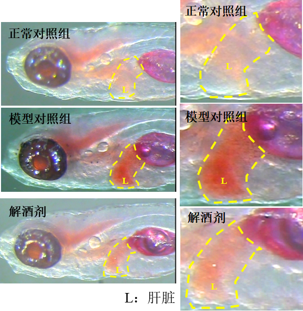利用斑马鱼模型评价疏肝解酒（酒精性脂肪肝防治）功效