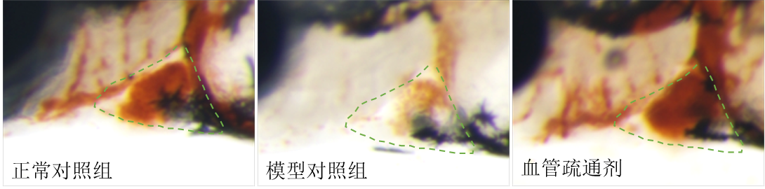 利用斑马鱼模型评价疏通血管（抗红细胞损伤性血栓）功效