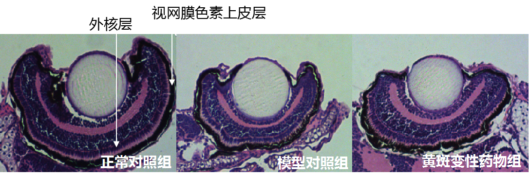 利用斑马鱼模型评价湿性黄斑变性防治作用